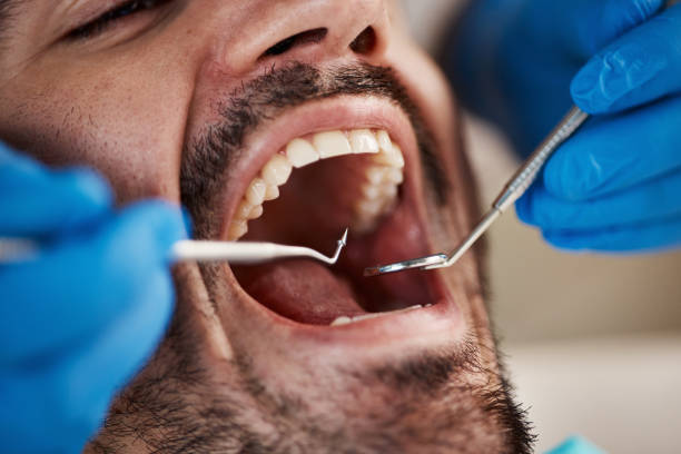 Best Emergency Root Canal Therapy in Kiln, MS