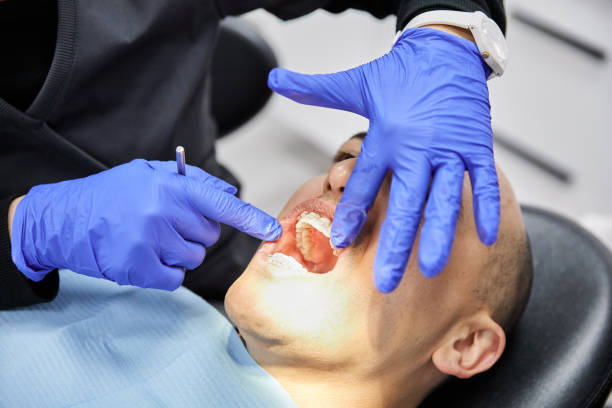 Best Broken or Chipped Tooth Repair in Kiln, MS